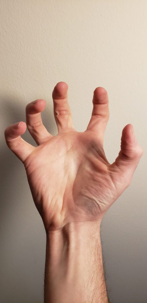 Hand photo