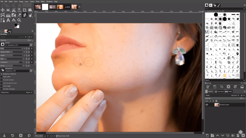 Removing a skin blemish